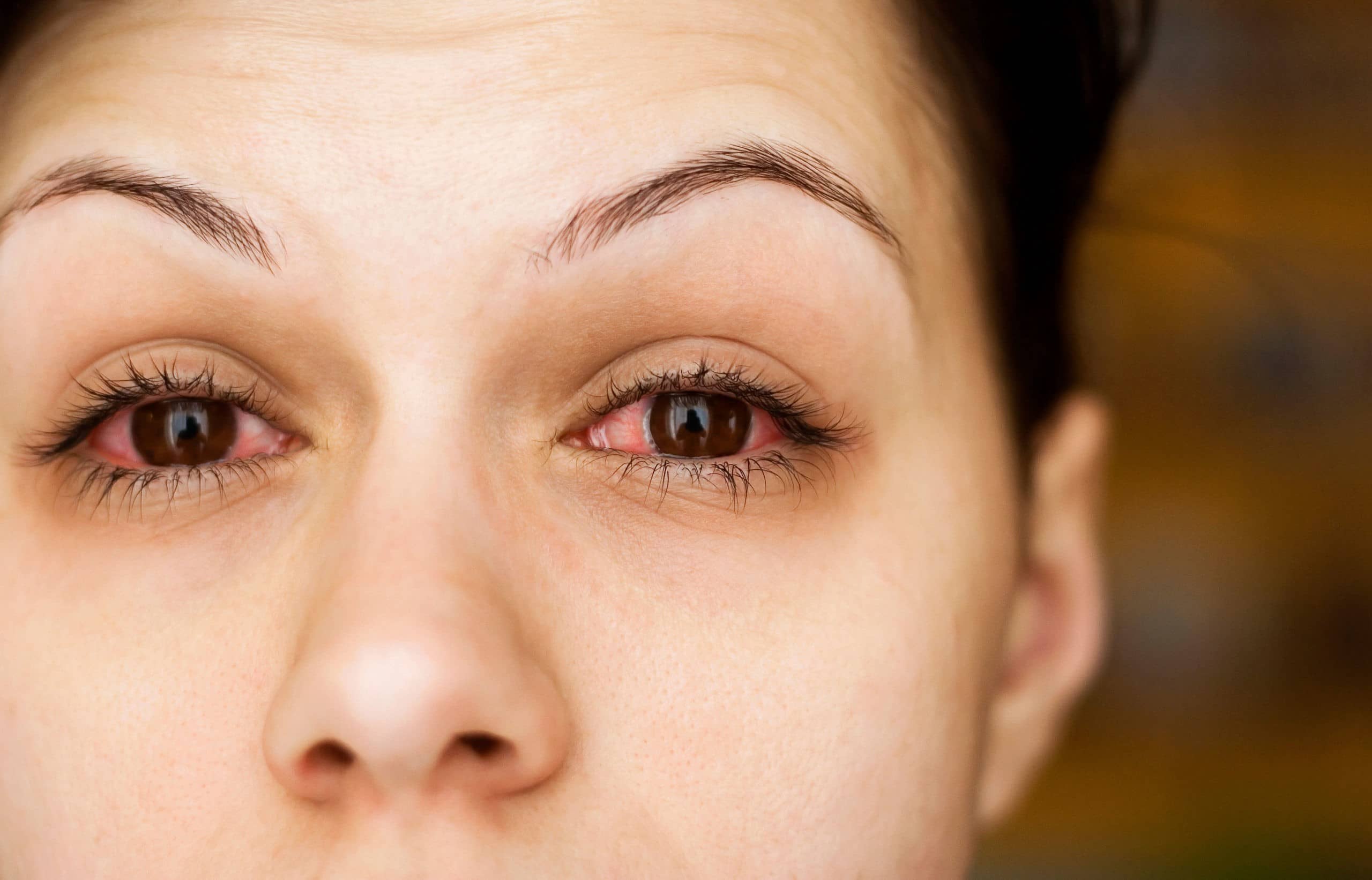 Dry Eye Disease Treatment in Austin TX