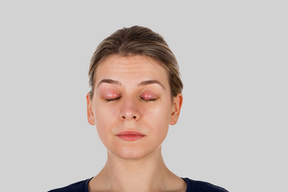 Dry Eye Disease Treatment in Austin TX